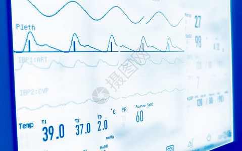 医院的床边心脏状况监测器图片