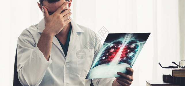 医生分析X射线胶片上显示的2019年冠状或Covid19影片展示了冠状感染患者肺部和呼吸器官的象征医疗技术和图片