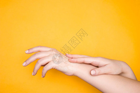 手与皮肤干裂的手皮肤问题的概图片