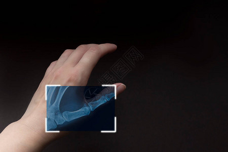 棕色背景的手部X光片扫描手带有生物鉴别技术的远期技术以图片