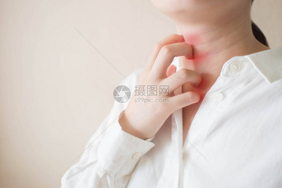 年轻女子用红疹搔她脖子上的痒皮肤发痒的原因包括昆虫叮咬皮炎药物过敏或皮肤干燥保健概念复图片