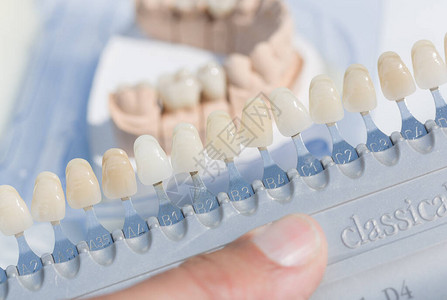 在牙科实验室检查牙齿印记上的人造牙列贴面的特写图片