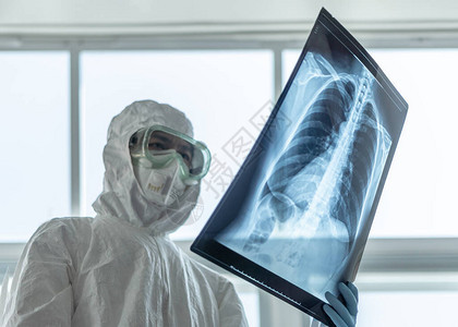 COVID19冠状或新型冠状流行病与医生或实验室技术科学家在PPE个人防护设备中持有肺胸部X射线图像图片