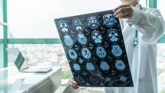 脑部疾病诊断与医生看磁共振成像MRI胶片诊断老年患者神经退行疾病问题的图片