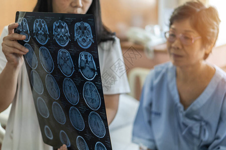 脑部疾病诊断与医生诊断老年患者神经退行疾病问题看到用于神经医学治疗的磁共振成像M图片