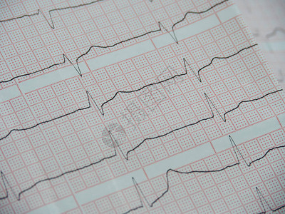 白纸上的心脏电图红色的细胞在一图片