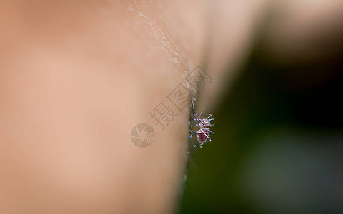 携带登革热的蚊子渗入人的皮肤吸血图片