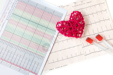 红藤心脏心电图记录和带有早期预警信号的患者生命体征表健康的心脏和优图片