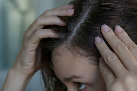 一位漂亮年轻女子在前检查头皮和头发根颜色白发脱发或头皮干图片