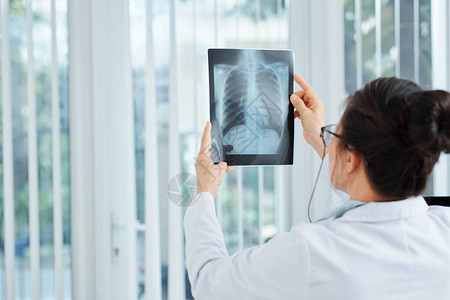 检查肺部X射线的病人表明病例的图片