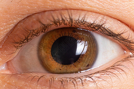 2023-06-23眼角膜塑形图片塑形镜图片角膜图片硬性角膜塑形镜图片角膜