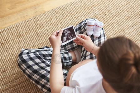 孕妇手持超声图像怀孕保健妇科的概念等待婴儿的年轻母亲特写图片