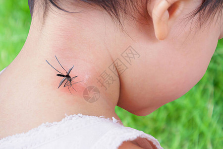 在户外玩耍时被蚊子咬和吸血使颈部皮肤有图片