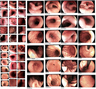 采集胃肠内分泌检查图像图片
