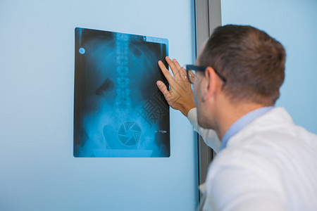 男医生检查医院脊柱的X光图片