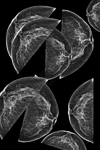 女乳房的侧位乳房X线照片在更高的放大倍数下背景图片