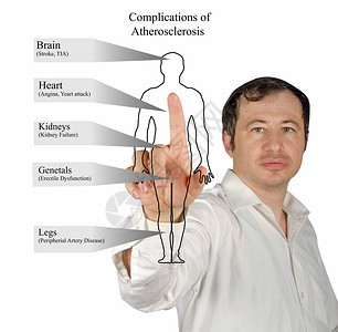 Atherrosc硬化图片