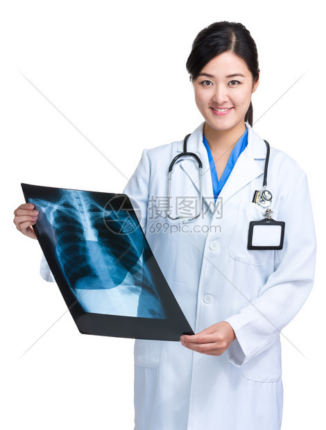 亚洲年轻女医生与白色背景上的x射线图片