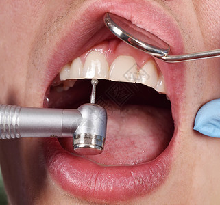 牙科医使用牙科钻牙图片