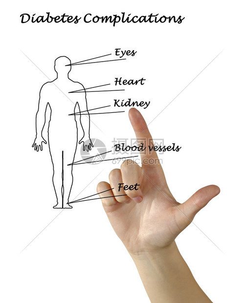 糖尿病并发症图片