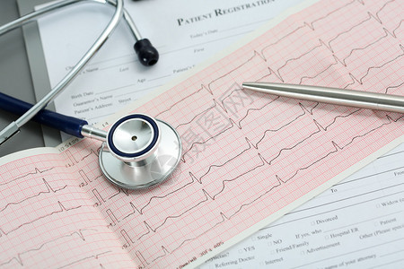 听诊器头和银笔躺在剪贴板垫上的心电图上心脏治疗师协助医生制作心脏生理脉搏测量文件心律失常理念图片