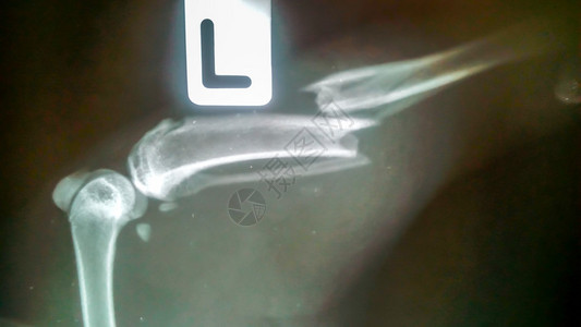X光片被猫咬断腿的流浪狗图片