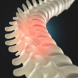 人类脊椎模型背景图片