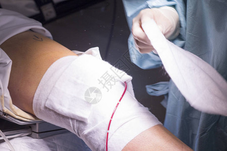 骨科医院手术室急诊室手术膝关节镜显微手术后的护士包扎图片