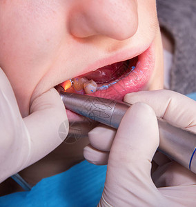 牙科医生在诊所做病人图片