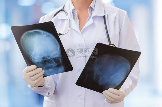 医生手中的X光片诊断病人图片