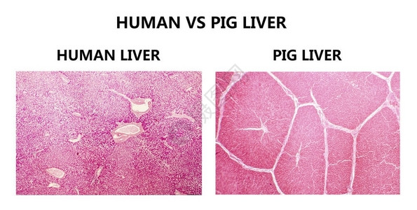 人和猪肝组织学图片