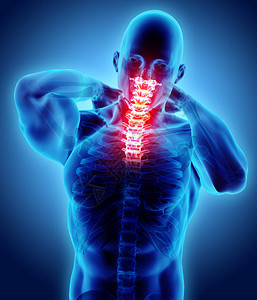 3D说明颈部疼痛宫颈脊椎骨X背景图片