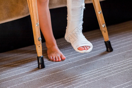 腿断了成了无法辨认的小石膏孩子年轻骨科女孩在家里拄着拐杖拐杖断腿脚踝受伤儿童骨折和踝关节骨折图片