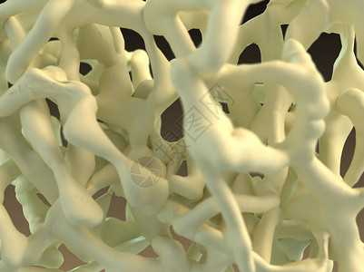骨质疏松症研究骨骼3d渲染背景图片