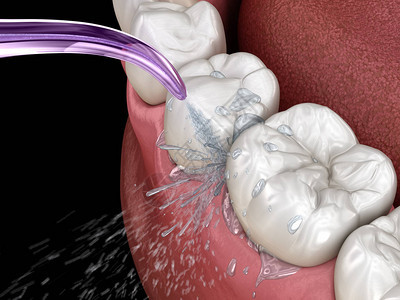 喷水员清净水牙准确的3D背景图片