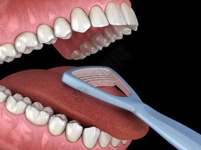 口腔卫生的3D插图医学上准确无误地说图片