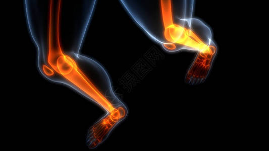 人体骨骼共同疼痛解剖脚和腿联合症3图片