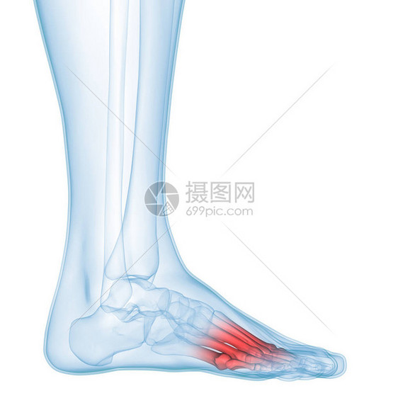 人体骨合体疼痛解剖Leg联合3图片