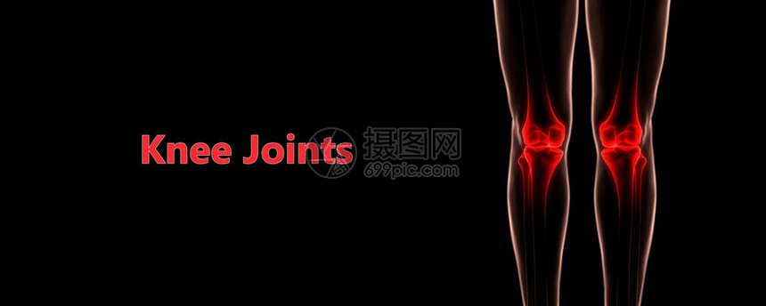 人体骨骼系统膝关节疼痛联合图片