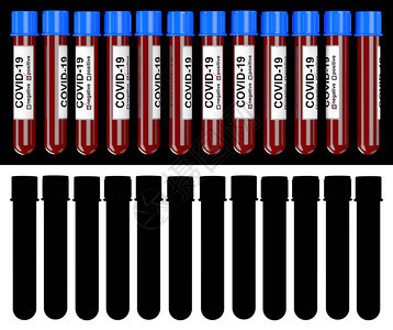 说明许多血液测试管图片