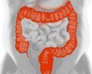 肠结肠直肠细菌的医学图片
