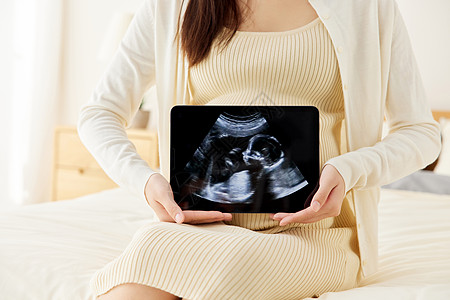 女性生育怀孕准妈妈手拿b超图特写背景