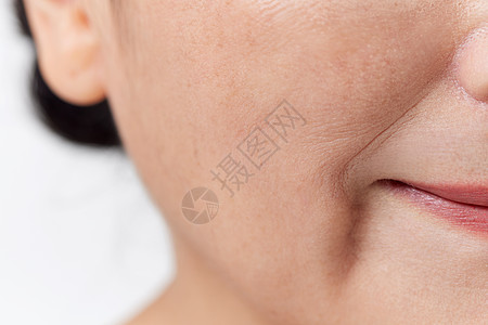 面部护肤中年女性法令纹特写背景