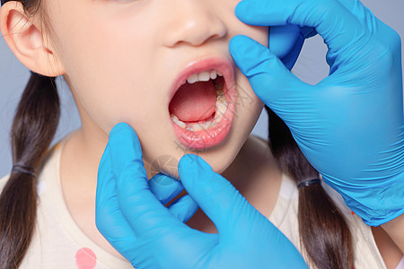远离牙痛张嘴检查牙齿的儿童背景