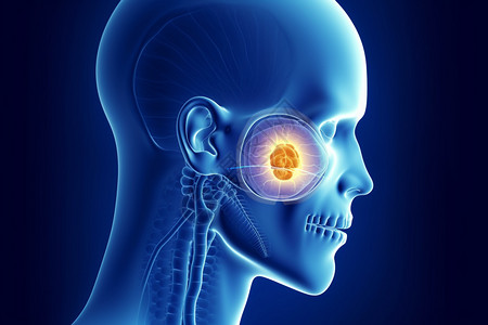 医学咽鼓管损伤概念图图片