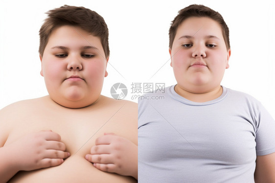 男孩的肥胖症图片