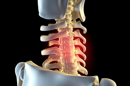 病变的脊柱背景图片