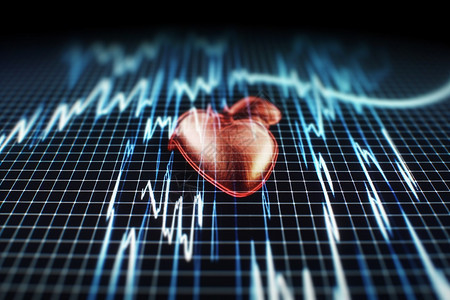 医疗心跳数据图背景图片