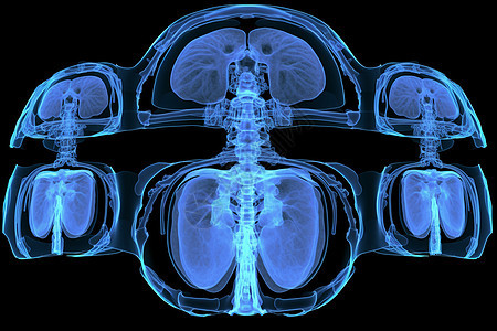 腹部MRI扫描图片