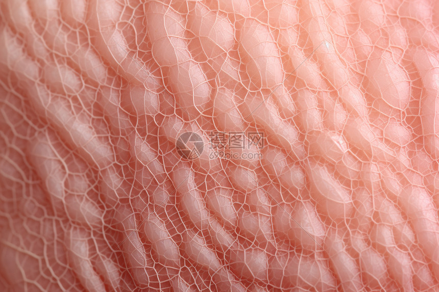 皮肤真皮组织图片